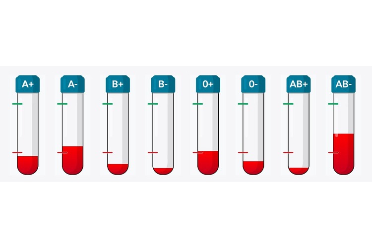 ['darivanje krvi', 'krvna grupa', 'smanjene zalihe krvi']