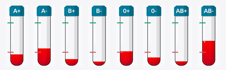 ['darivanje krvi', 'krvna grupa', 'smanjene zalihe krvi']